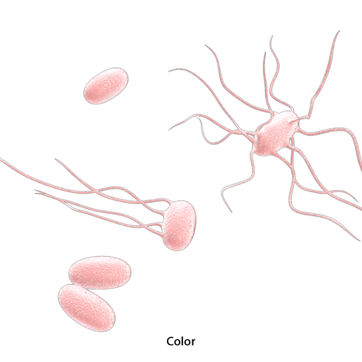 Typhoid_Color_1.png Fièvre typhoïde Maladie bactérienne