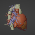 3.png 3D Model of Heart (from real patient)