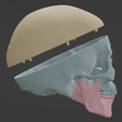 8.png 3D Model of Skull, Skull Cap and Mandible