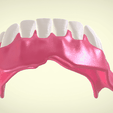 Screenshot_13.png Full Dentures with Many Production Options