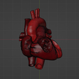 w3.png 3D Model of Heart with Atrial Septal Defect
