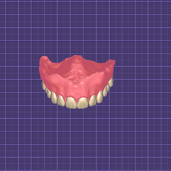 Captura-de-pantalla-2023-06-25-133850.png Complete Denture + Dental Models