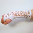 IMG_20210202_121315.jpg Armschiene