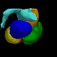 4.png 3D Heart Model - generated from real patient