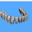Dentes-Mandibula-Robtoly-Unique-Exocad-01.jpg Teeth Lower Jaw - Exocad - Robtoly-Unique