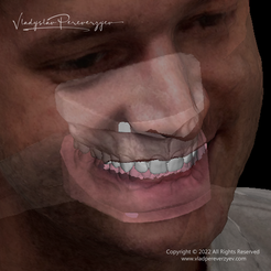 Virtual-Patient-Face-Scan,-Dicom,-IO-Scans,-Dental-Model-2-Vladyslav-Pereverzyev.png Virtual Patient (Face Scan, Dicom, IO Scans, Printable Models) - Software