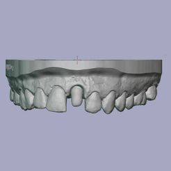 Capture.jpg STL-Datei Dental Master model 21 with antagonist・Modell zum Herunterladen und 3D-Drucken