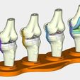 5.jpg total knee replacement model ( TKR ), EDUCATING / TEACHING MODEL