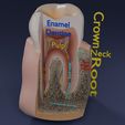 image-0032.jpg Corte esquemático de los dientes etiquetado