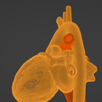 30.png 3D Model of Heart after Fontan Procedure