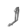 Both_bone_malunion_sag_40_degrees.png Entire collection of simulated forarm angulated malunions