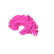 4.png White matter of right temporal lobe SEGMENTED