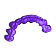3.stl articulated model plus provisional bridge / Articulated model plus provisional bridge