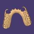 Clipboard-2024-08-24-14-54-25.jpg DIGITAL FLEXIBLE PARTIAL REMOVABLE DENTURE (4 stl files)