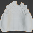 Kennedy-Class-I-Mod-1-Maxillary-8.png Prosthodontics Kennedy Class I Mod 1 Maxillary Removable partial denture (RPD)