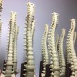 IMG_5212.jpg SPINE WITHOUT SUPPORTS PROFESSIONAL MEDICINE