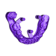 2025-02-24_00005-001-36-35-34-33-32-31-41-42-43-44-45-46-47-modelbase.stl exocad Dentallabor
