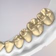 18.jpg 3D Dental Jaws Replica with Detachable Teeth