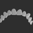 veneers.png Dental Model With 10 Veneers and Articulator