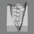 ANA-SANTIESTABAN1.jpg Dental Model/ Dental Model