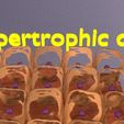 1103.jpg adaptation epithelial cell changes normal to cancer Low-poly 3D model