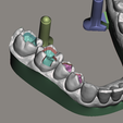 meshmixer_tMMsnG3U5e.png Dental Models for Practice
