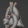 21.png 3D Model of Heart after Fontan Procedure