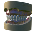 30.png Digital Full Dentures with Combined Glue-in Teeth Arch