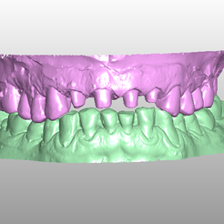 Model_21.png Previous dental models