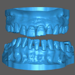 2023-10-04_17-12-21.png Upper and lower tooth