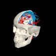 cvfdbghnjuykiol.jpg 3D Model of Brain Arteriovenous Malformation
