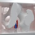 mold.jpg Anatomical Femoral Artery Cannulation Simulator for Ultrasound Guidance