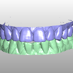 Model_16.png STL file Dental model to create coping・Model to download and 3D print