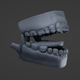 M8.png Mouth with Braces