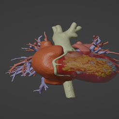 1.png Modèle 3D d'un cœur humain sain - généré à partir d'un vrai patient