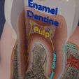 aa0005.jpg Corte esquemático de los dientes etiquetado