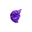 STL00004.stl 3D Model of Human Heart with Anomalous Pulmonary Venous Drainage (APVC) - generated from real patient