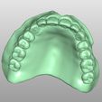 Clipboard-2024-02-25-14-55-40.jpg TOTAL REMOVABLE DENTURES (upper + lower + artificial teeth)