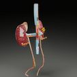renal-cell-carcinoma-3d-model-df47bc8909.jpg Renal cell carcinoma 3D model