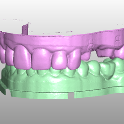 Model_32.png STL file Dental model bridge・3D printable model to download