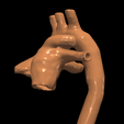27.png 3D Model of Transposition of the Great Arteries Open Duct