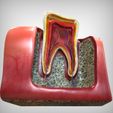 Alternate2_View.jpg Tooth cutaway