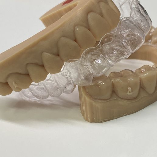 IMG_5817.jpg Fichier STL LES DEUX MAXILLARS - SUPÉRIEUR et INFERIEUR scan intraoral (IOS) - AREA3D - Patient A. dentition complète・Design imprimable en 3D à télécharger, superdiente