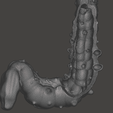 colon,-intestine,-mesenteric,-diverticulitis,-inflammation,-anatomy,-abdominal,-abdomen-5.png 3D Дивертикулит толстой кишки (обновлено)