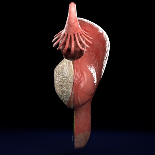 6.jpeg Útero normal frente a tipos de fibromas 3d set