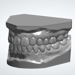 Capture.jpg Dental study models