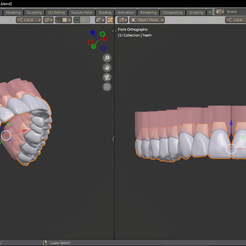 imagen_2022-09-18_215351063.png OBJ file 2. COMPLETE ARCH OF TEETH WITH SOCKET AND GUM・3D printer model to download