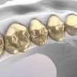 23.jpg 3D Dental Jaws Replica with Detachable Teeth