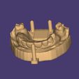 Clipboard-2024-12-21-00-32-42.jpg DIGITAL FLEXIBLE PARTIAL DENTURES upper + lower (3D models !!!) - 10 stl files for download