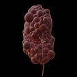 11.jpg 3D Model of Polycystic Kidney
